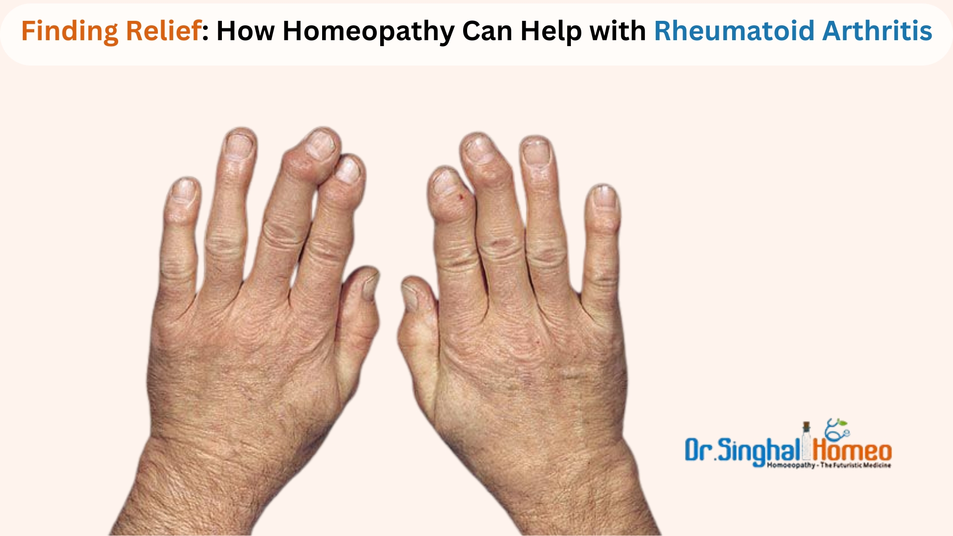 Finding the Best Doctor for Rheumatoid Arthritis Treatment: A Comprehensive Guide – health