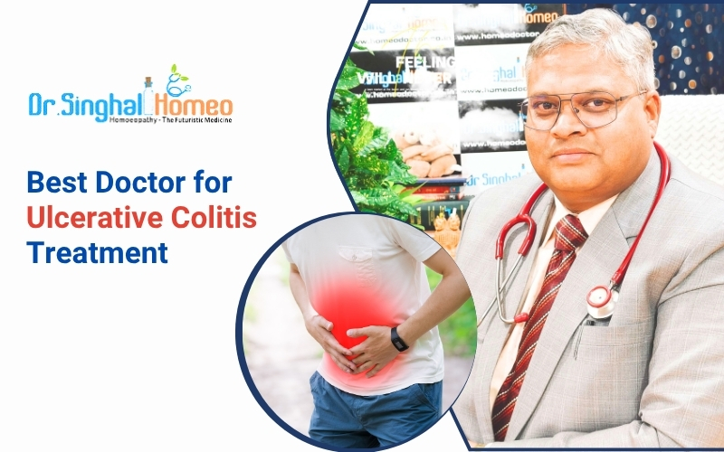 Finding the Best Doctor for Ulcerative Colitis Treatment
