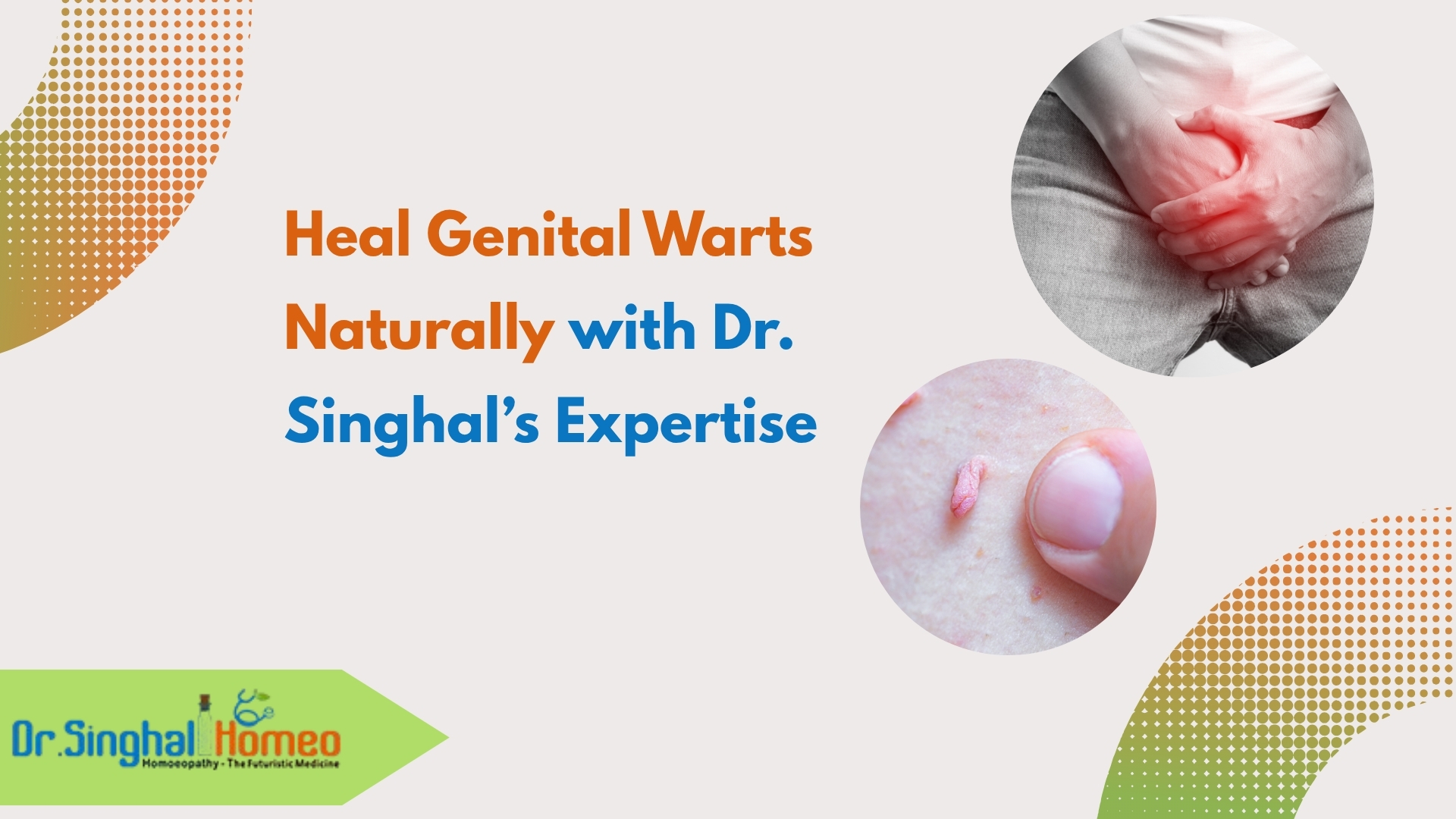 Homeopathic Treatment for Genital Warts: Natural Relief That Works – health