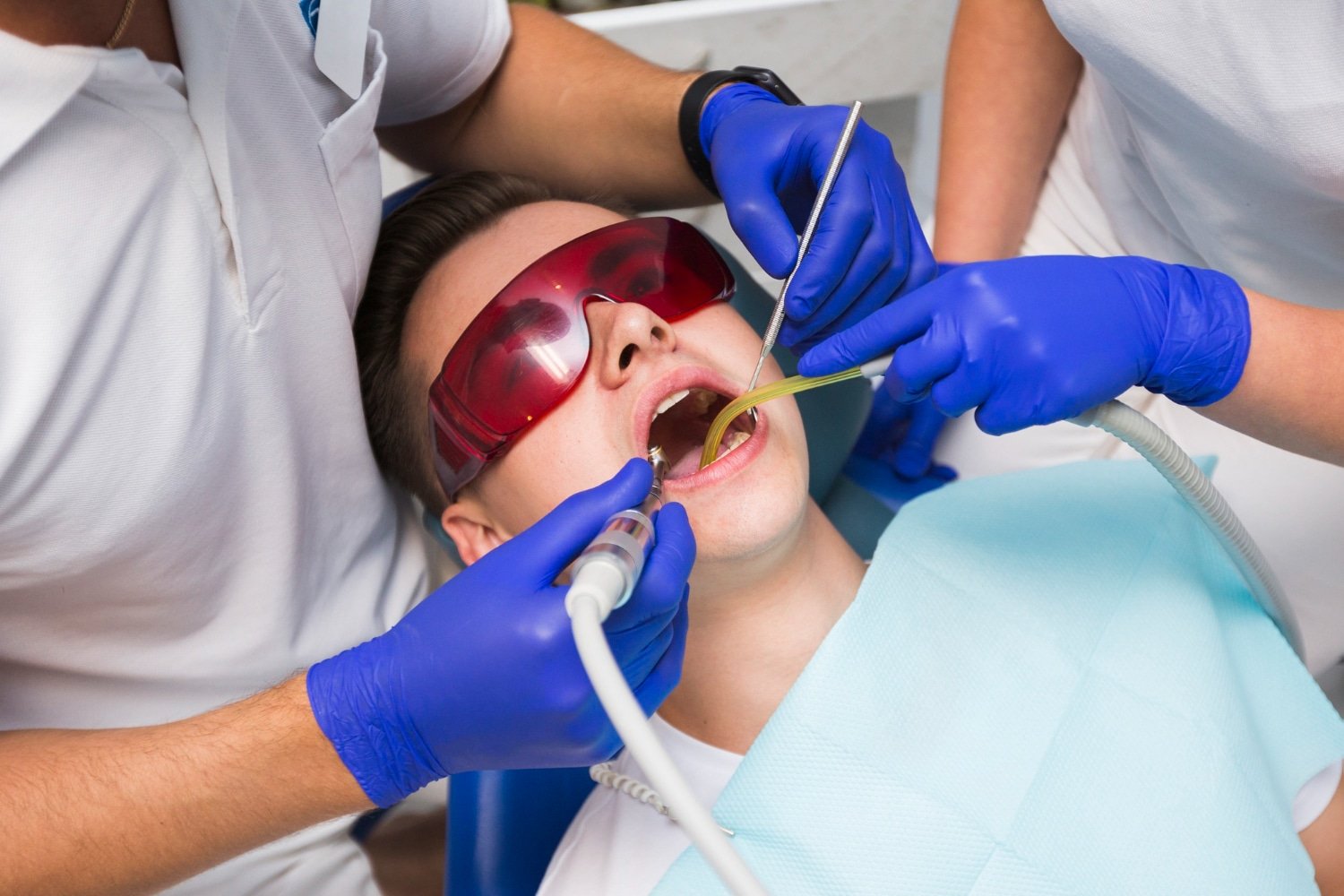 Teeth Whitening: What is it, Types, Benefits, And Side Effects