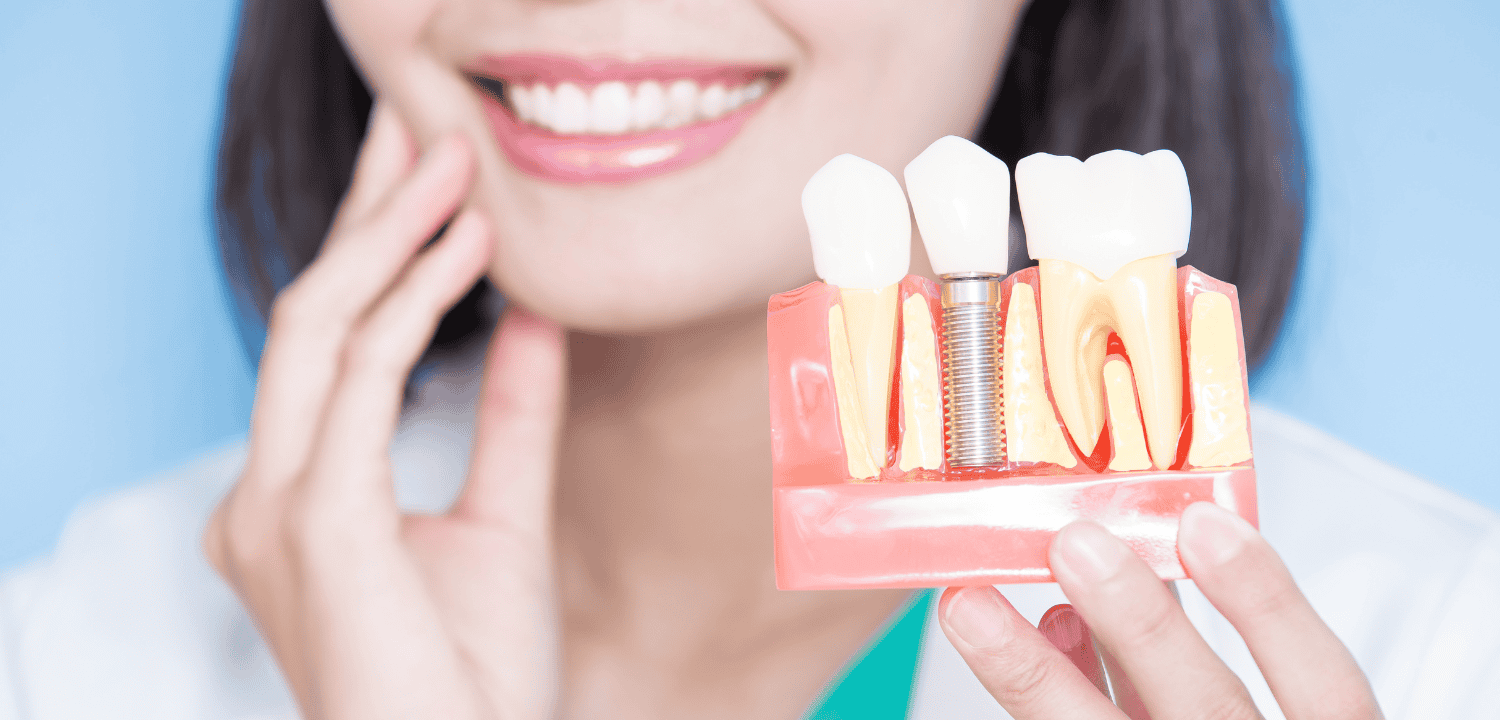 Dental Implant Puchong Price Guide