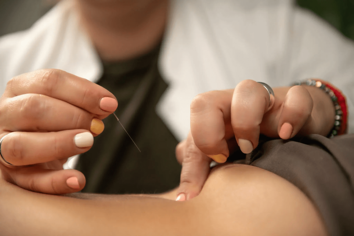 How Acupuncture Helps Relieve Chronic Pain in Scarborough, ON? – BodyandSole