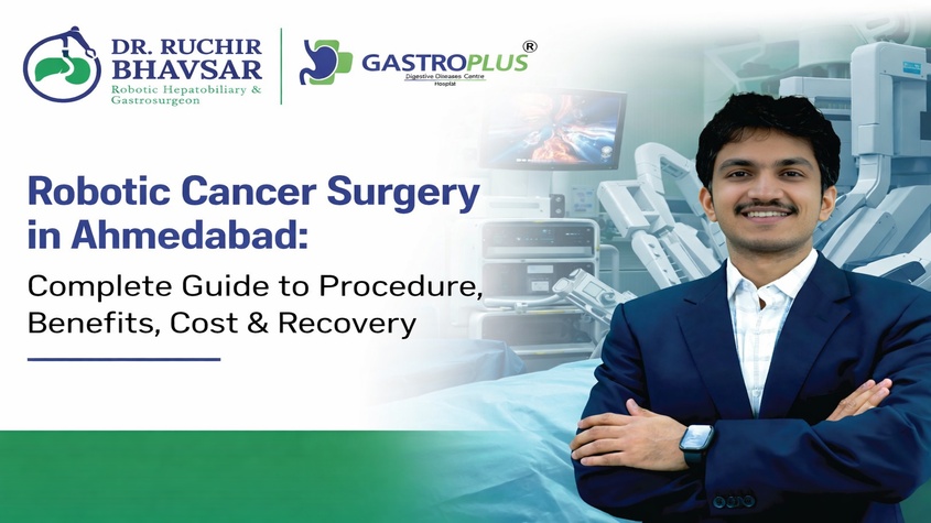 Robotic Cancer Surgery in Ahmedabad: Benefits & Recovery