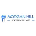 Morgan Hill Dentistry implants