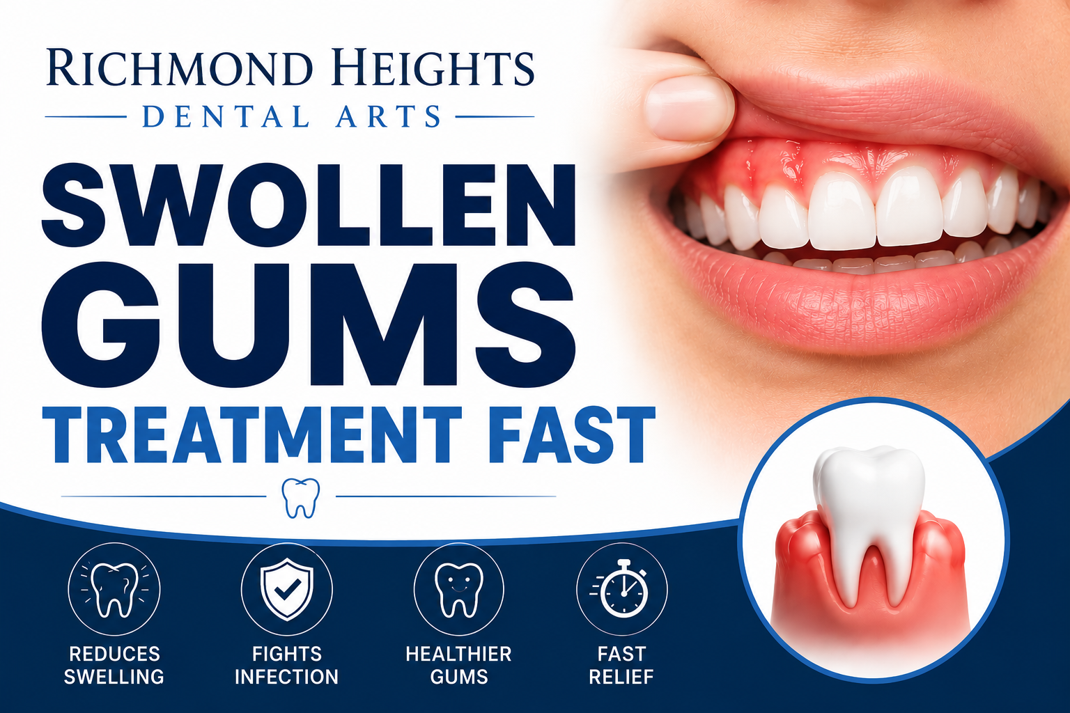 Swollen gums treatment fast - Richmond Heights dental arts
