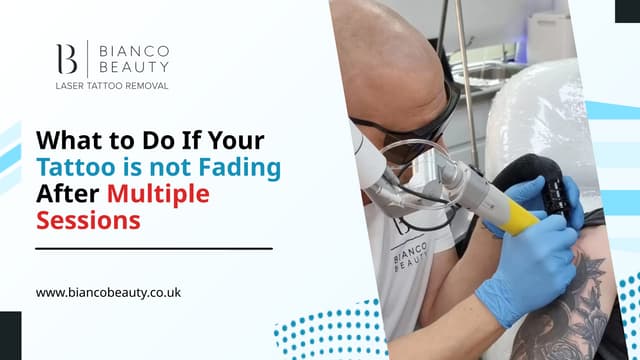 What to Do If Your Tattoo is not Fading After Multiple Sessions | PPTX