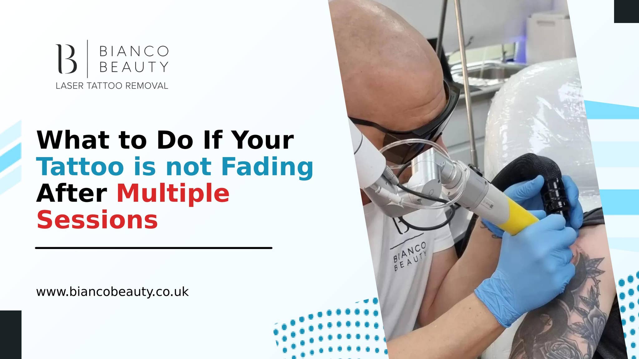 What to Do If Your Tattoo is not Fading After Multiple Sessions by bianco_beauty_miltonkeynes - Issuu