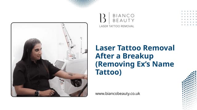 Laser Tattoo Removal After a Breakup (Removing Ex’s Name Tattoo) | PPTX