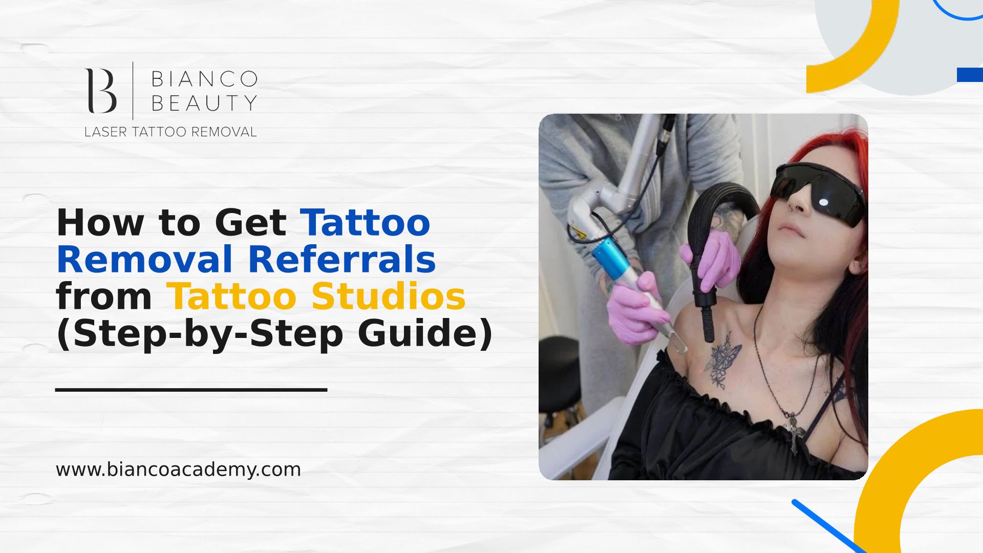 How To Get Tattoo Removal Referrals From Tattoo Studios (Step-by-Step Guide)