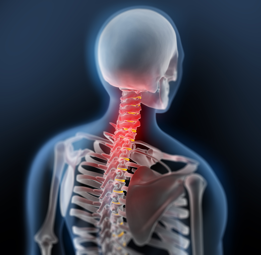 Cervical Arthroplasty in Stone Oak, TX | Brain and Spine Institute